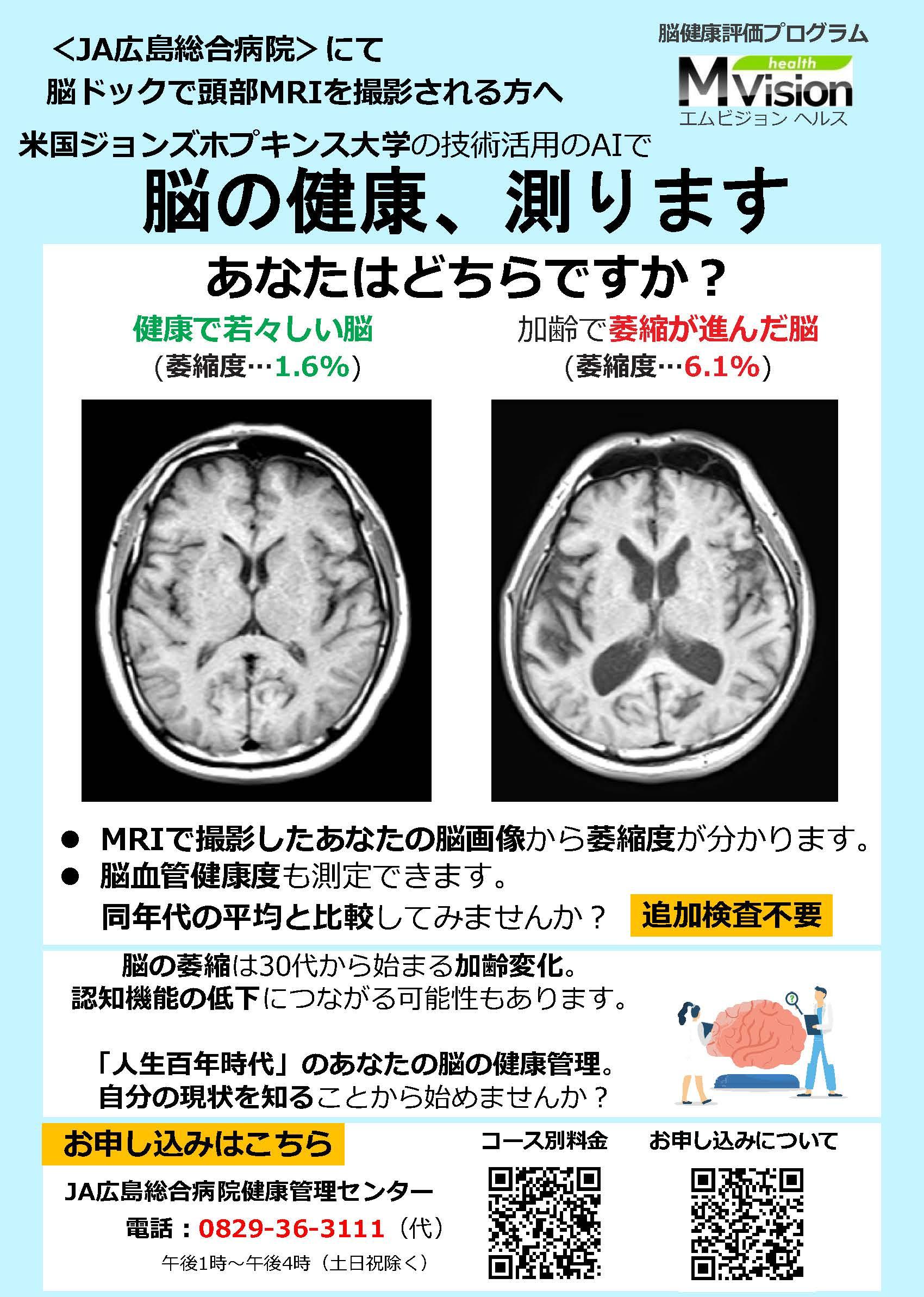 脳年齢AI診断.jpg