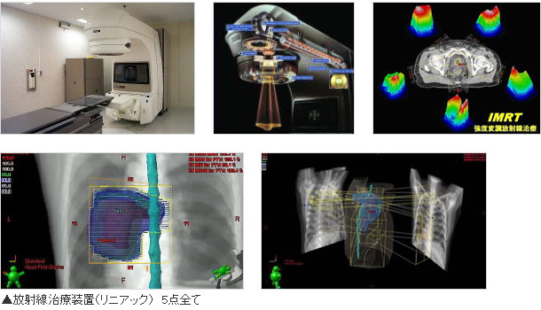 放射線治療装置の写真