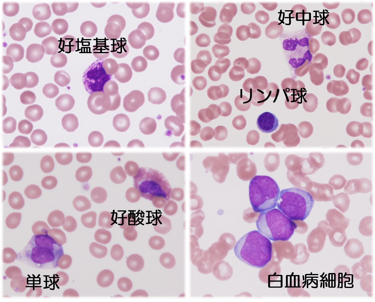 血液 一般検査室 検査室のご紹介 臨床研究検査科 医療支援部門 診療のご案内 Ja広島総合病院